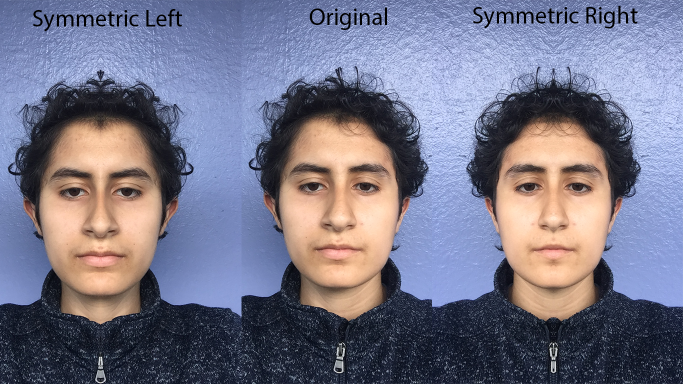 An image of a face, on one side edited to make both sides symmetrical based on the left side of the face, on the right is the reciprocal of that.