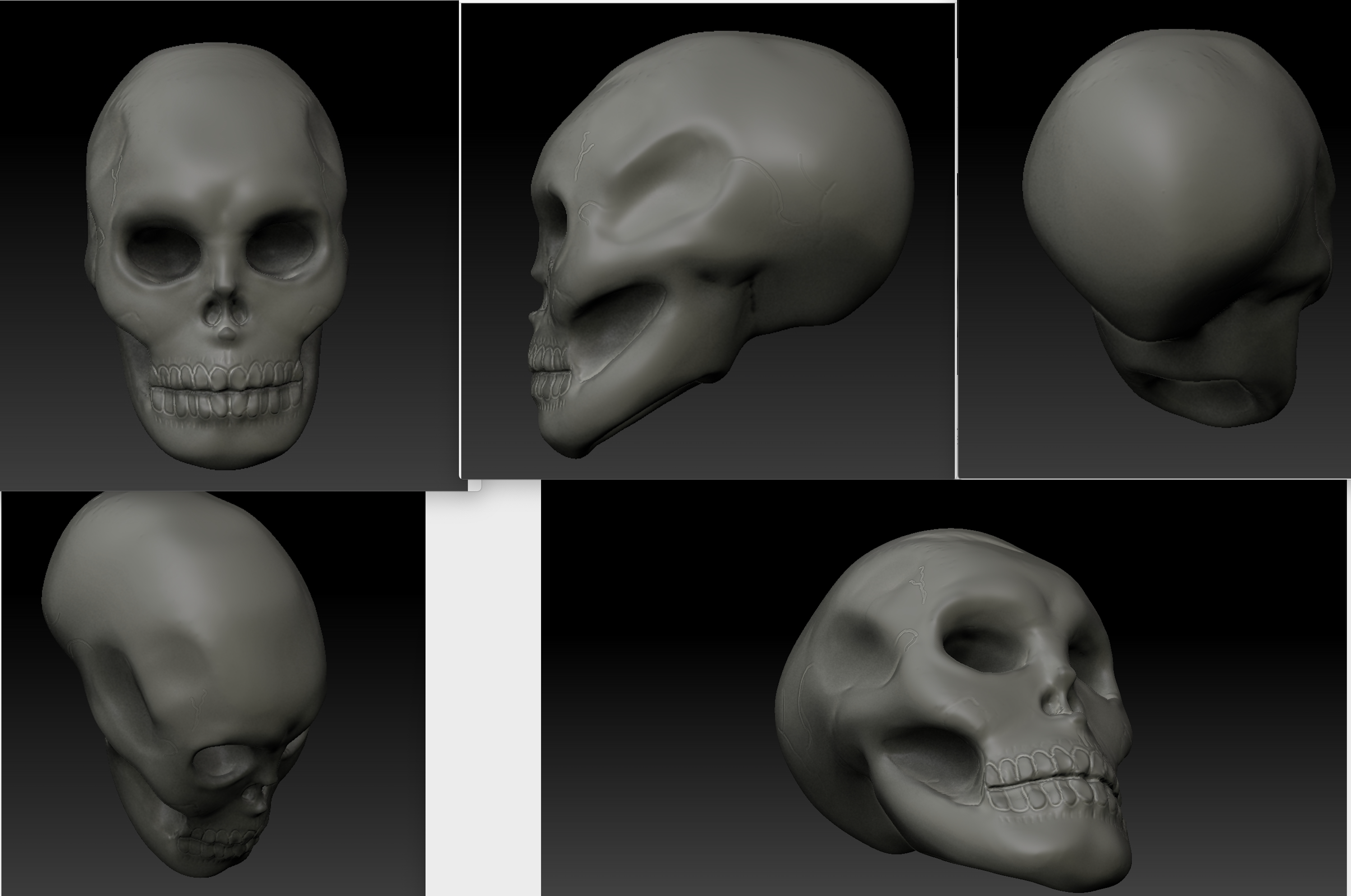 Different perspectives of a skull