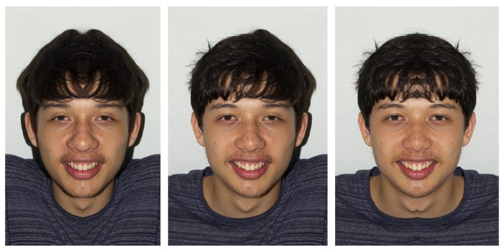 This is an edit of my brother face. I reflected the light side and his left side of the face. 